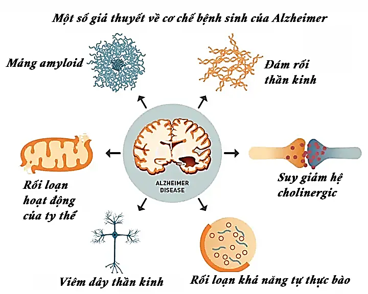 Bệnh Alzheimer – Tiến bộ trong điều trị dựa trên các dẫn chất tetrazol